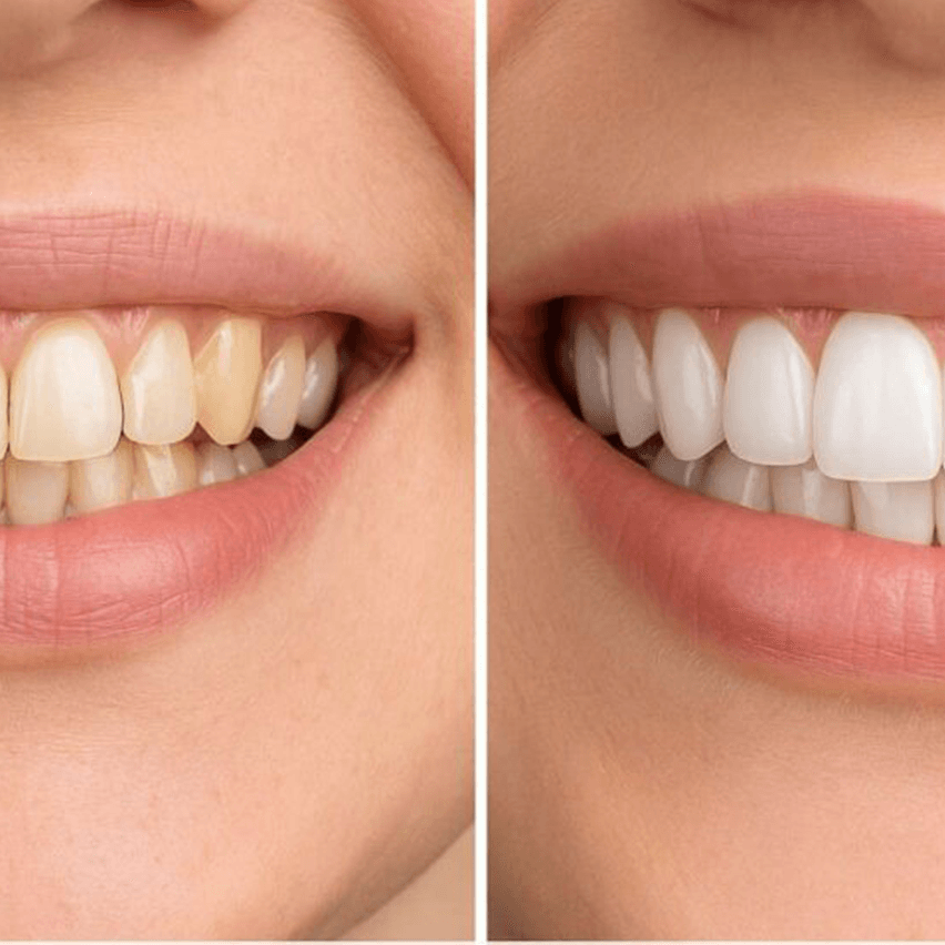Before After